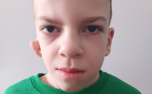 Apel za malenog dječaka: Pred Eminom (7) je važna borba, evo kako možete pomoći
